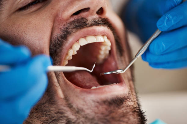 Best After-Hours Dental Trauma Care in West Van Lear, KY